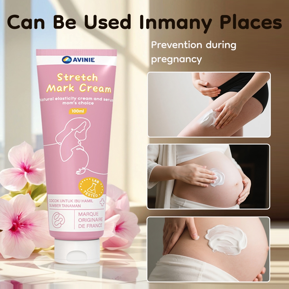 Avinie Stretch Mark Cream BPOM 041024005650400020009 Penghilang Stretch Mark Original Foto 4