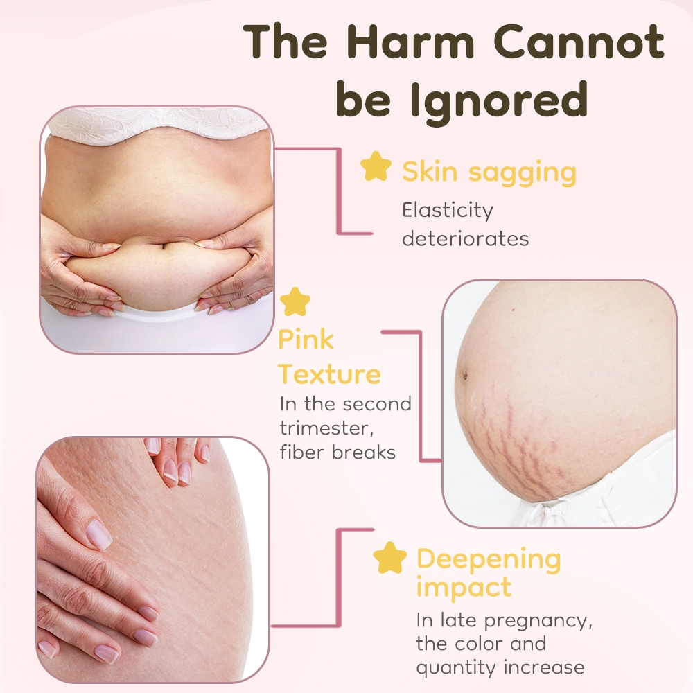 Avinie Stretch Mark Cream BPOM Foto 2
